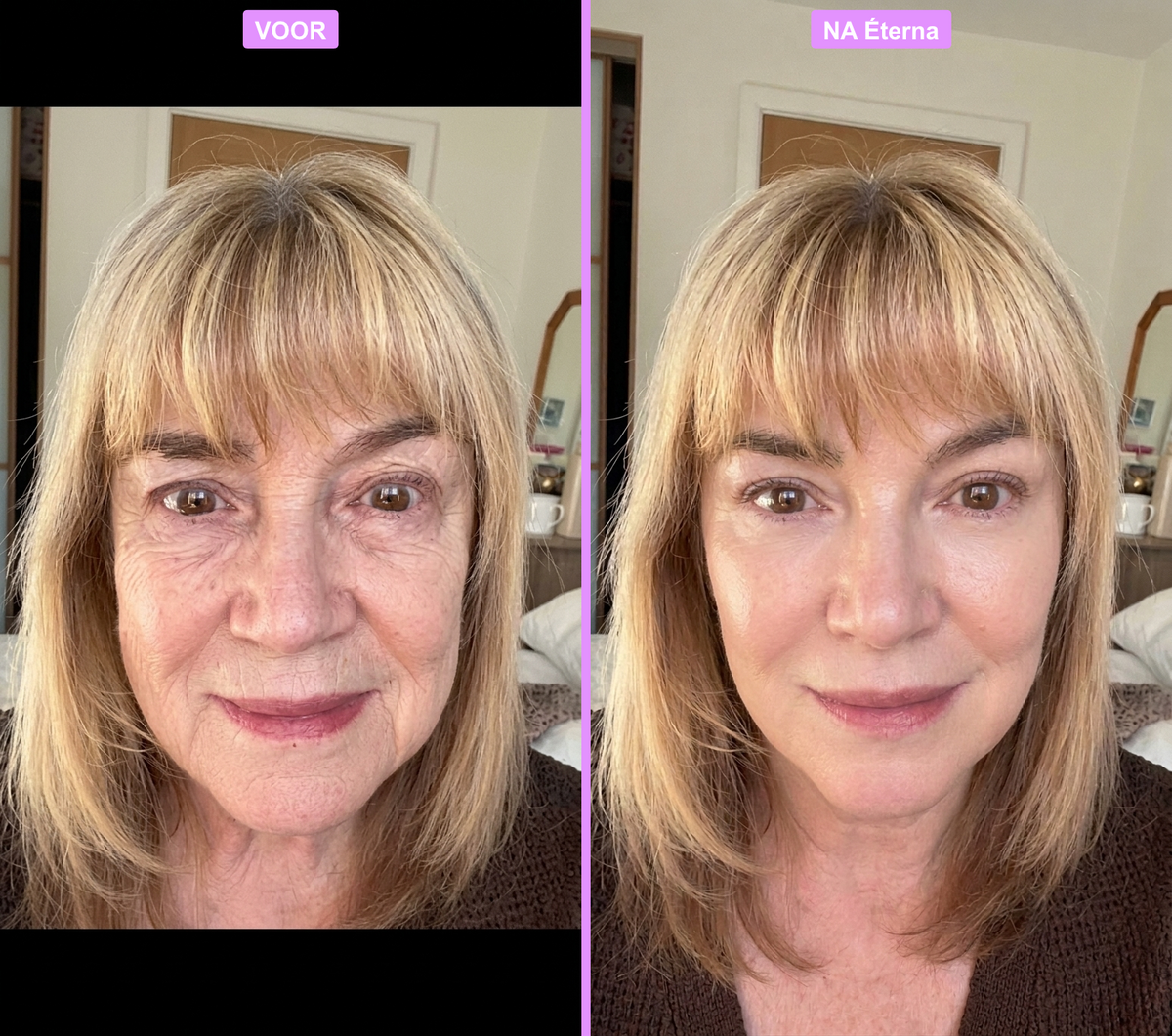 Ageless AM/PM Cream