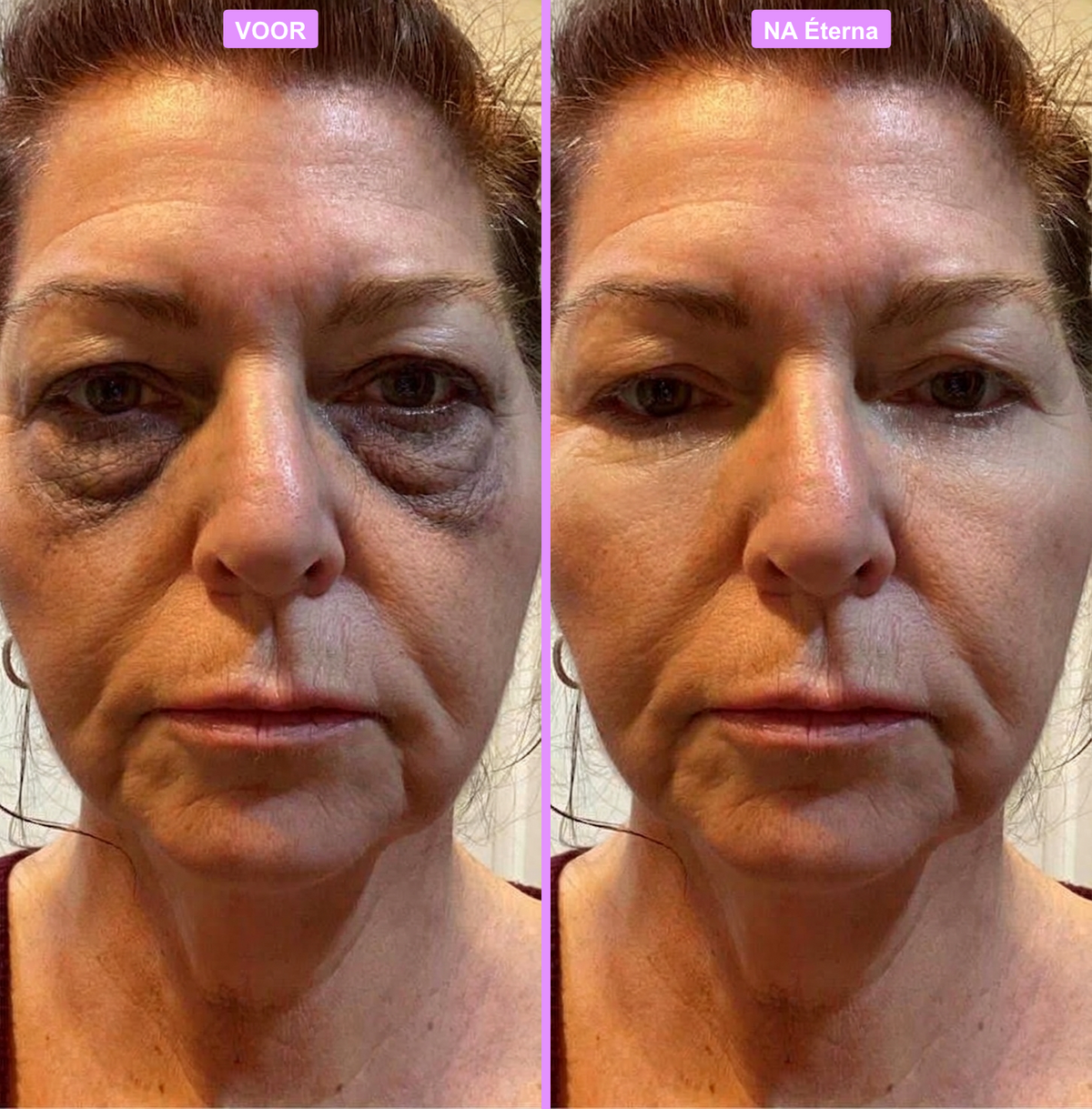 Age - Defying Eye Cream